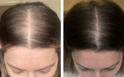 Injectable Solutions Therapy