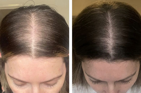 Injectable Solutions Therapy